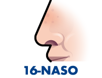 Naso